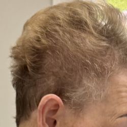 K&K Hair Salon - You can see scalp