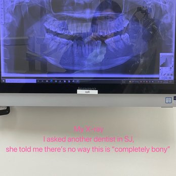Campus Dental Care - X-ray - General Dentistry Near Me - Berkeley, California Campus Dental Care - X-ray - General Dentistry Near Me - Berkeley, California