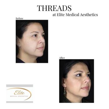 Elite Medical Aesthetics - Medical Spas Near Me - Eagle, Idaho