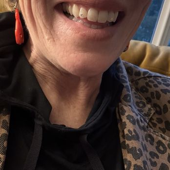 Skye Tattoo - Fun teeth gems! I love them!!! - Tattoo Near Me - Arlington, Washington Skye Tattoo - Fun teeth gems! I love them!!! - Tattoo Near Me - Arlington, Washington