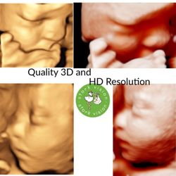 Stork Vision Ultrasound Imaging Center - 3D, 4D and HD Ultrasound