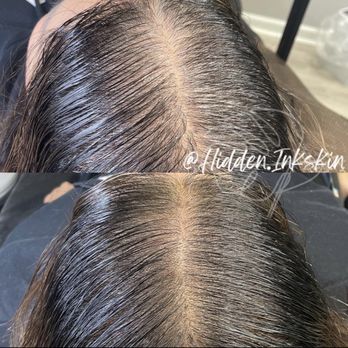 Hidden Ink Skin - Scalp Micro Pigmentation - Tattoo Near Me - San Jose, California Hidden Ink Skin - Scalp Micro Pigmentation - Tattoo Near Me - San Jose, California
