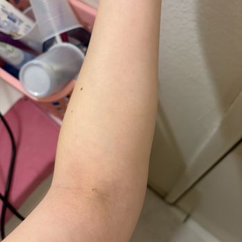 Quest Diagnostics - First poke was not successful - Laboratory Testing Near Me - Hacienda Heights, California