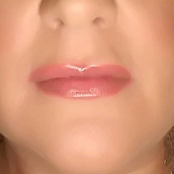Fabulous Faces - Medical Spas Near Me - Tucson, Arizona