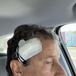 DeLuke Dermatology - Area was cleaned and extremely well bandaged and covered.