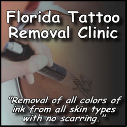 Florida Tattoo Removal Clinic