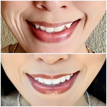 Johnson Ranch Dental - General Dentistry Near Me - Roseville, California Johnson Ranch Dental - General Dentistry Near Me - Roseville, California