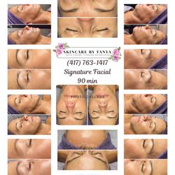 Skincare By Tanya - 90-min Signature Facial with dermaplaning, no-downtime peel, VDA Peptides, LED therapy & microcurrent mask for smooth, glowing skin.