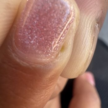 Metro Nail Lounge - Infection - Nail Salons Near Me - Corona, California Metro Nail Lounge - Infection - Nail Salons Near Me - Corona, California