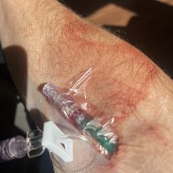 SGMC Health - Worst IV I've ever received