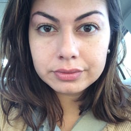 Uneven eyebrows