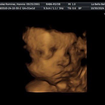 La Bella Belly - Baby girl in 3D 31 weeks - Skin Care Near Me - Heath, Texas La Bella Belly - Baby girl in 3D 31 weeks - Skin Care Near Me - Heath, Texas