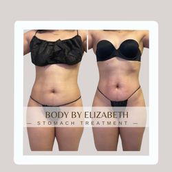 Body By Elizabeth - Unleash your true potential with our body sculpting treatments!
Witness incredible inch loss results that will leave you speechless