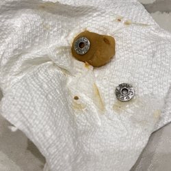 Trattoria Romana - The disgusting glob of??? With a metal piece attatched
