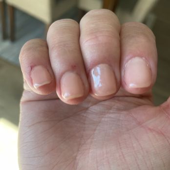 Classy Nails - Over buffed nails and skinned fingers - Nail Salons Near Me - Castle Pines, Colorado