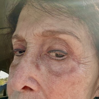 Skin Totale Med Spa - Skin damage - Medical Spas Near Me - Orange, California Skin Totale Med Spa - Skin damage - Medical Spas Near Me - Orange, California