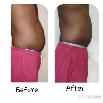 Bodiedbykia - Body contouring is the process of Sculpting the body to help aid in weight loss.. - Body Contouring Near Me - College Park, Georgia Bodiedbykia - Body contouring is the process of Sculpting the body to help aid in weight loss.. - Body Contouring Near Me - College Park, Georgia