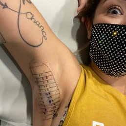 MiraDry - temp tattoo