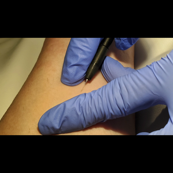 DFW Electrolysis - Sterile equipment, disinfected procedures, gloves, everything is opened up in front of you. You are in good hands with professionals. - Hair Removal Near Me - North Richland Hills, Texas
