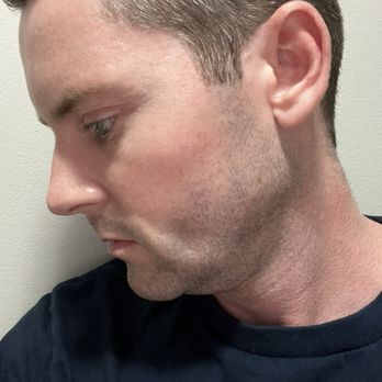 Jonathan Zelken, MD - Cosmetic Surgeons Near Me - Newport Beach, California