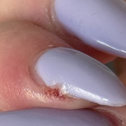 Nice Nails - Infected pinky because my natural nail was ripped to the nail bed.