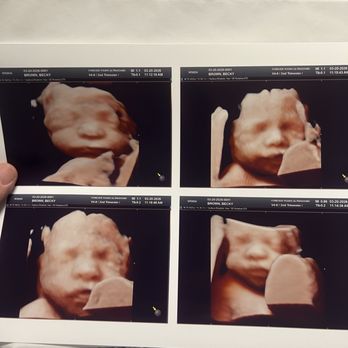 Forever Yours Ultrasound - 4d ultrasound - Prenatal/Perinatal Care Near Me - Irvine, California Forever Yours Ultrasound - 4d ultrasound - Prenatal/Perinatal Care Near Me - Irvine, California