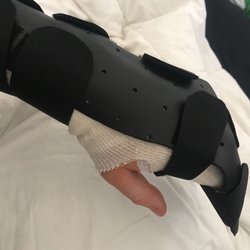 Grasp Hand Therapy