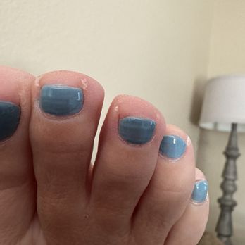 Blanca labella Day Spa - The middle toe was cut to a nub. One of my most painful toes. My nail use to cover my entire toe on all toes. - Nail Salons Near Me - Roseville, California Blanca labella Day Spa - The middle toe was cut to a nub. One of my most painful toes. My nail use to cover my entire toe on all toes. - Nail Salons Near Me - Roseville, California