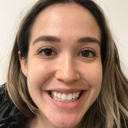 Before Invisalign. My smile was not as wide, teeth were hidden. Sorry it's so close up that's how they take photos there LOL. Before Invisalign. My smile was not as wide, teeth were hidden. Sorry it's so close up that's how they take photos there LOL.