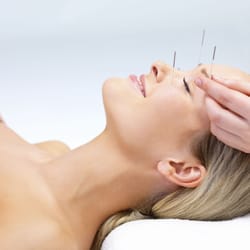 Cabo Massage Acupuncture - Acupuncture treatment for pain and stress