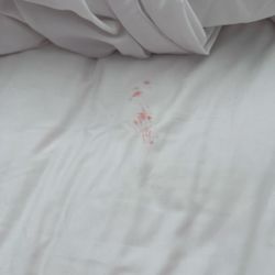 Holiday Inn Express Marietta - Atlanta Northwest - Red unidentified stains on bedding