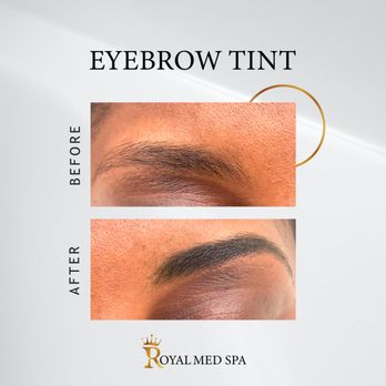 Royal Med Spa - The eyebrow tint services at Royal Med Spa is done to the eyebrow area - Medical Spas Near Me - The Bronx, New York
