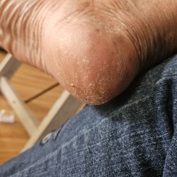 Honey Nails & Spa - My other heel I'm so upset