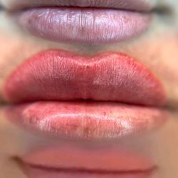 Lux Glowz - Lip blush before , after, & healed