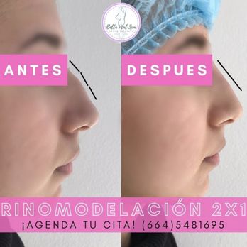 Bella Vital Spa - Medical Spas Near Me - Tijuana, BCN
