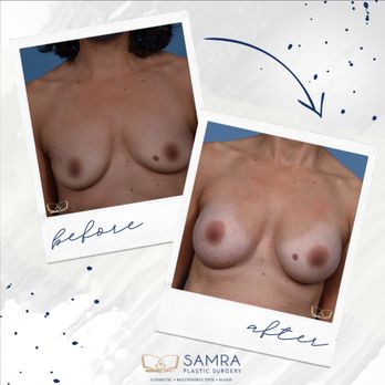 Samra Plastic Surgery - Confidence restored, curves enhanced, dreams realized. Call us today to book your consultation! - Plastic Surgeons Near Me - Holmdel, New Jersey Samra Plastic Surgery - Confidence restored, curves enhanced, dreams realized. Call us today to book your consultation! - Plastic Surgeons Near Me - Holmdel, New Jersey