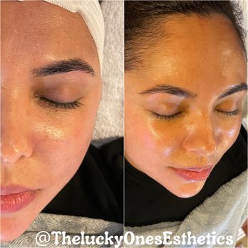 The Lucky Ones Esthetics - Estheticians Near Me - Redlands, California The Lucky Ones Esthetics - Estheticians Near Me - Redlands, California