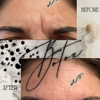 Aesthetx Haus - Botox - Medical Spas Near Me - Walnut Creek, California Aesthetx Haus - Botox - Medical Spas Near Me - Walnut Creek, California