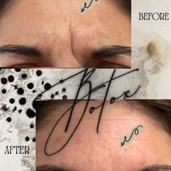 Aesthetx Haus - Botox