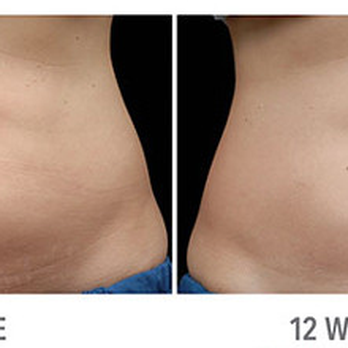 Your Best Body Today - Body Contouring Near Me - San Antonio, Texas Your Best Body Today - Body Contouring Near Me - San Antonio, Texas