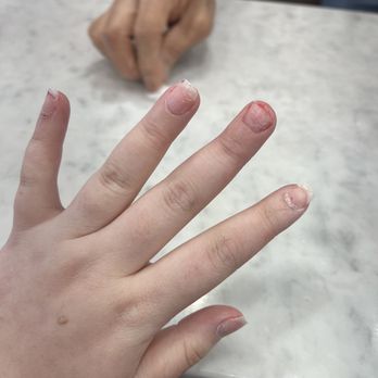 5 Forks Nails - After they were removed the damage - Nail Salons Near Me - Simpsonville, South Carolina 5 Forks Nails - After they were removed the damage - Nail Salons Near Me - Simpsonville, South Carolina