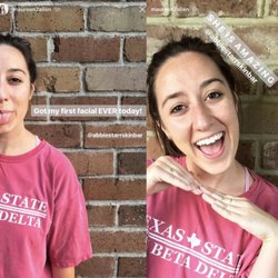 Abbie Starr Skin Bar - First facial selfie!