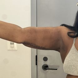 Bella Cosmetic Surgery - Result