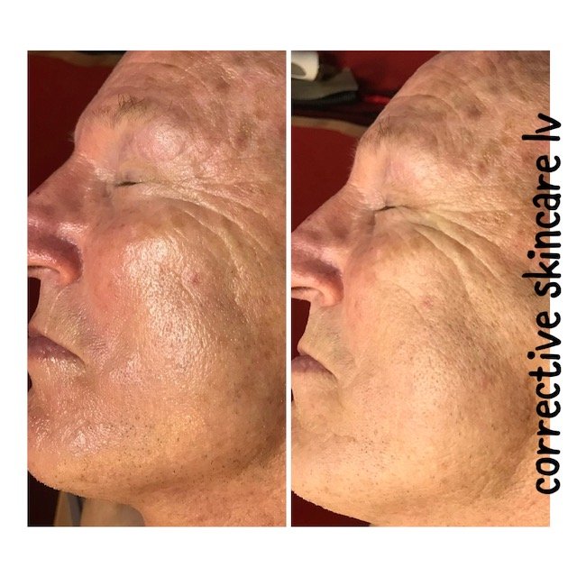 Corrective Skincare LV Logo