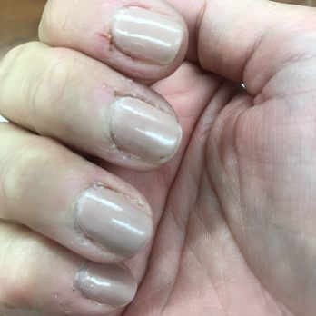 Ivy Nails Spa - Chipped polish just two days after manicure. You can see the clear top coat didn't go over the whole nail. - Nail Salons Near Me - Lima, Ohio