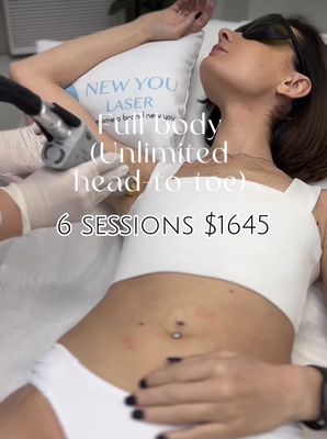 New You Laser by null