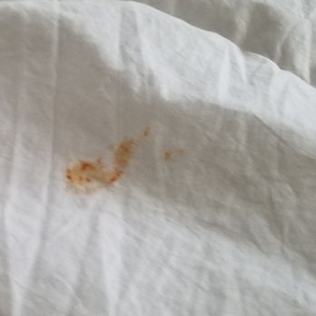 Hilton San Diego/Del Mar - Food Stains on Bed sheet - Hotels Near Me - Del Mar, California Hilton San Diego/Del Mar - Food Stains on Bed sheet - Hotels Near Me - Del Mar, California