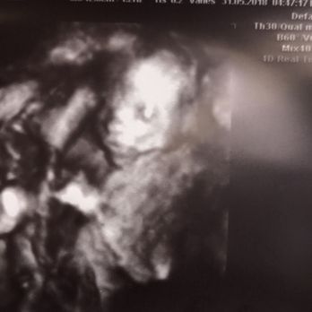 Tummy Time - Diagnostic Imaging Near Me - Salida, California Tummy Time - Diagnostic Imaging Near Me - Salida, California