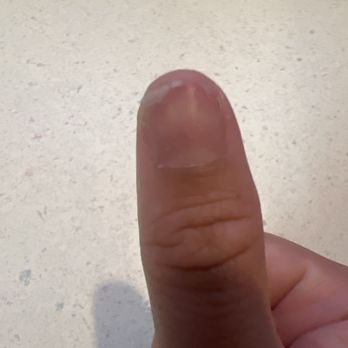 Euphoria Nails & Spa - this is the nail that she nicked. it's now very uneven and i had to cut it way too short just so that it wouldn't snag on things. - Nail Salons Near Me - Monrovia, California Euphoria Nails & Spa - this is the nail that she nicked. it's now very uneven and i had to cut it way too short just so that it wouldn't snag on things. - Nail Salons Near Me - Monrovia, California