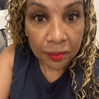 LaserAway - Mark up at lazer away for the Botox - Tattoo Removal Near Me - Arlington, Texas LaserAway - Mark up at lazer away for the Botox - Tattoo Removal Near Me - Arlington, Texas